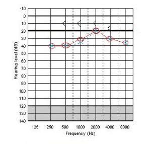 how hard is the meps hearing test|online hearing loss test.